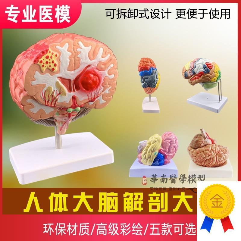 人体大脑模型f脑血管模型脑解剖模型医学教学用模型可拆分9倍件