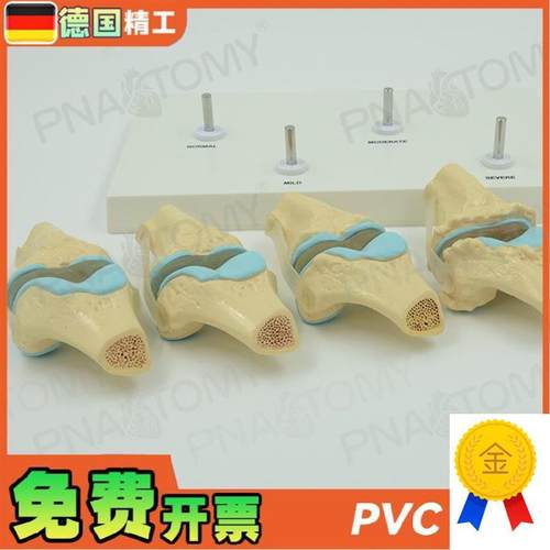 德国】人体膝g关节骨骼/病理模型关节骨质/病变教学膝盖骨外科疼
