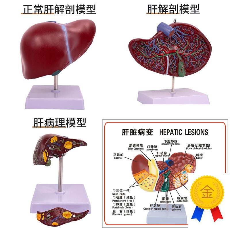 15009肝胆囊放大模型人体肝z胆囊肝脏人体消化器官内脏解剖模型