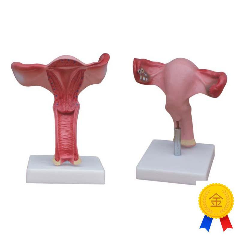子宫模型女性子宫放大解剖模型生殖系统生理结构教U育卵巢妇产教