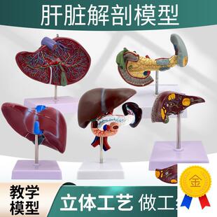 人体肾脏模e型肾解剖附肾上腺放大模型病变肾脏人体内脏器官解剖