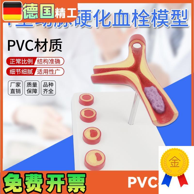 德国】Ya型动脉模型硬化带血栓模型人体血管医学教学模具