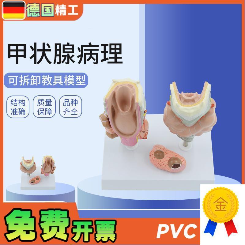 德国】甲状腺病理模型喉头解z剖模型教学用解剖甲状腺病理模具