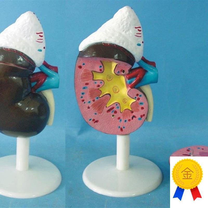 人体肾脏解剖模型器官解D剖医用教学讲解展示标本