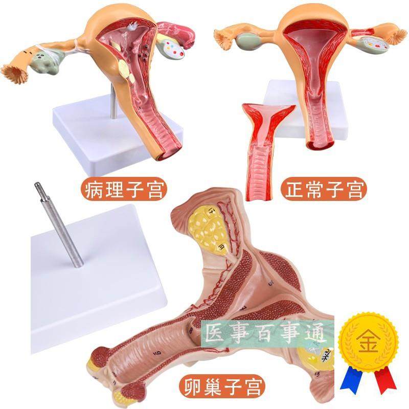 子宫模型女性内生殖器官生殖结构妇科模L型子宫解剖模型示教模型