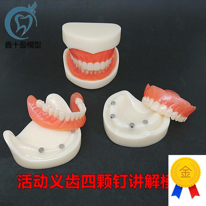 牙科模型活动义齿牙模讲解模型全口义G齿四颗钉教学模型T21包邮