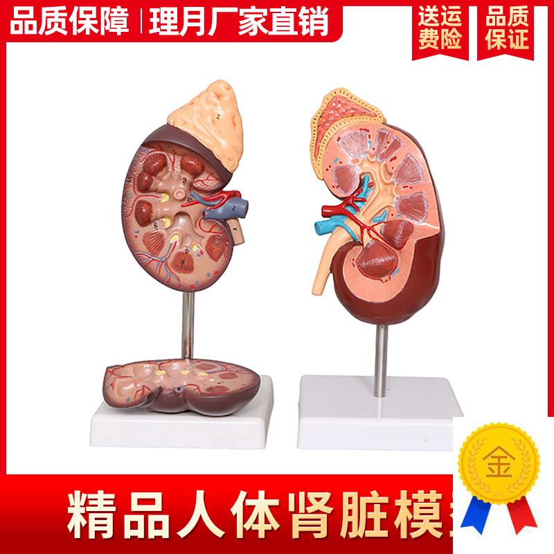 肾解剖模型标准人体肾脏肾上腺放大模型J病变肾脏内脏器官医学教
