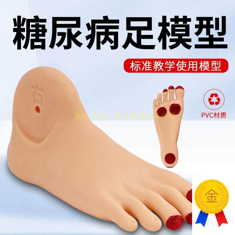 糖尿bing足护理模型观察足部病G理变化教具足部病变护理模型