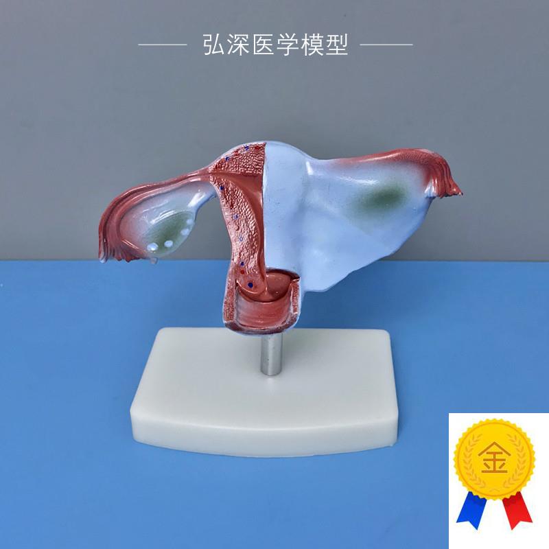 女性子宫模型人体生殖系统器官解剖卵H巢输卵管妇产科医学教学模