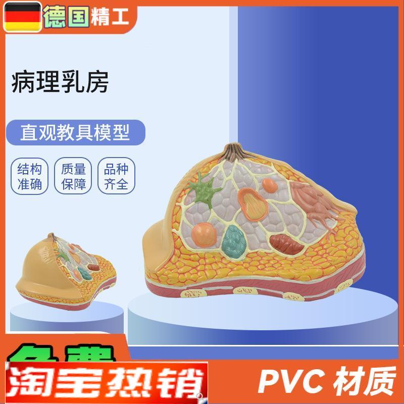 德国】PNT-0740  妇科乳房解剖模型  乳房病理解剖 乳房结构模型