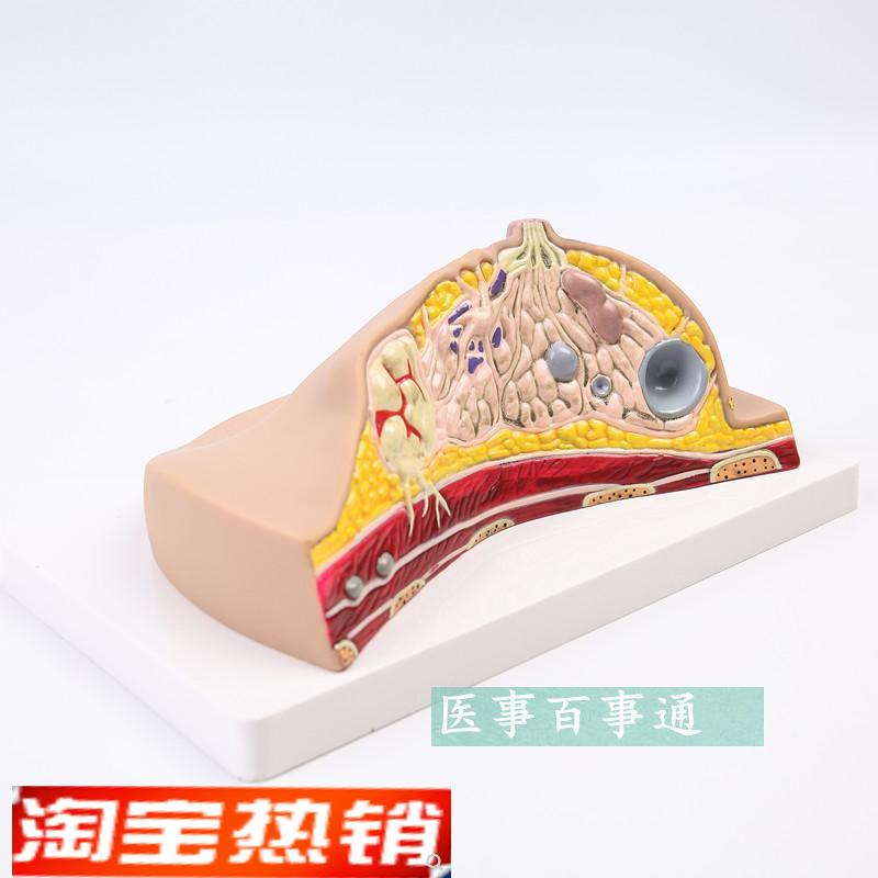 人体1:1乳房模型乳腺解剖女性生殖科普教育教学健康 厂家直销包邮