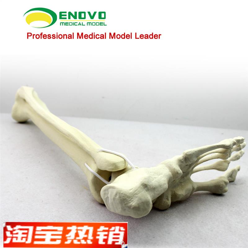 骨科手术摸拟Sawbone仿真骨人工合成骨模型足踝模型连接胫腓骨