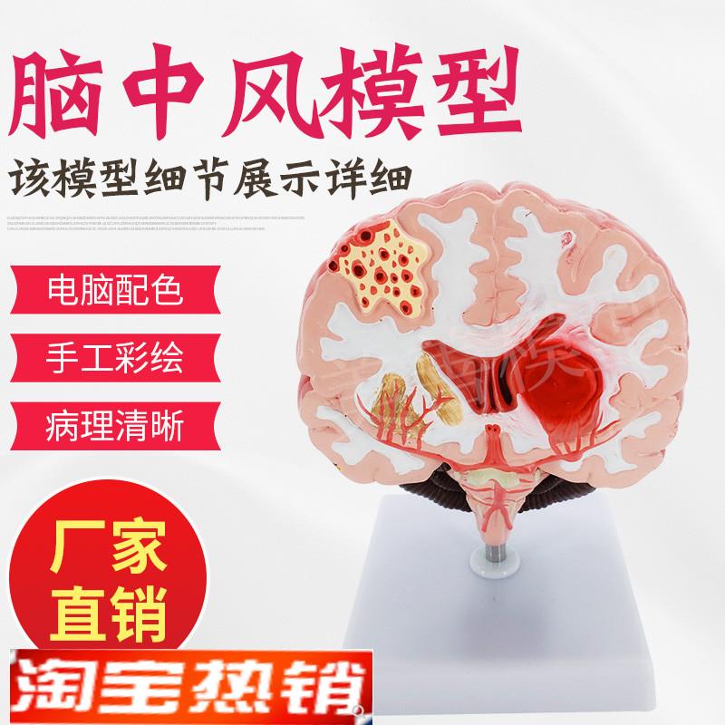 仿真人体脑部疾病模型大脑结构解剖神经内科医用学生教学模型