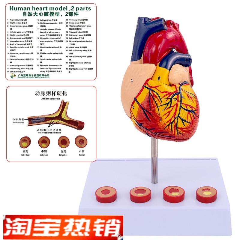蓝蝶正品 医学人体心脏解剖模型 B超彩超心脏标本心血管内科模型