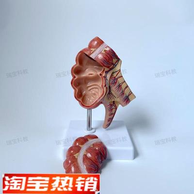 盲肠模型回盲部阑尾肠系膜人体消化道外科解剖教学模具肛肠科医用