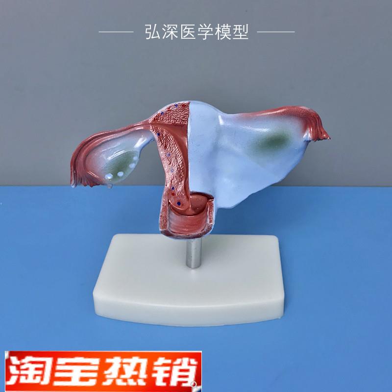 女性子宫模型人体生殖系统器官解剖卵巢输卵管妇产科医学教学模具