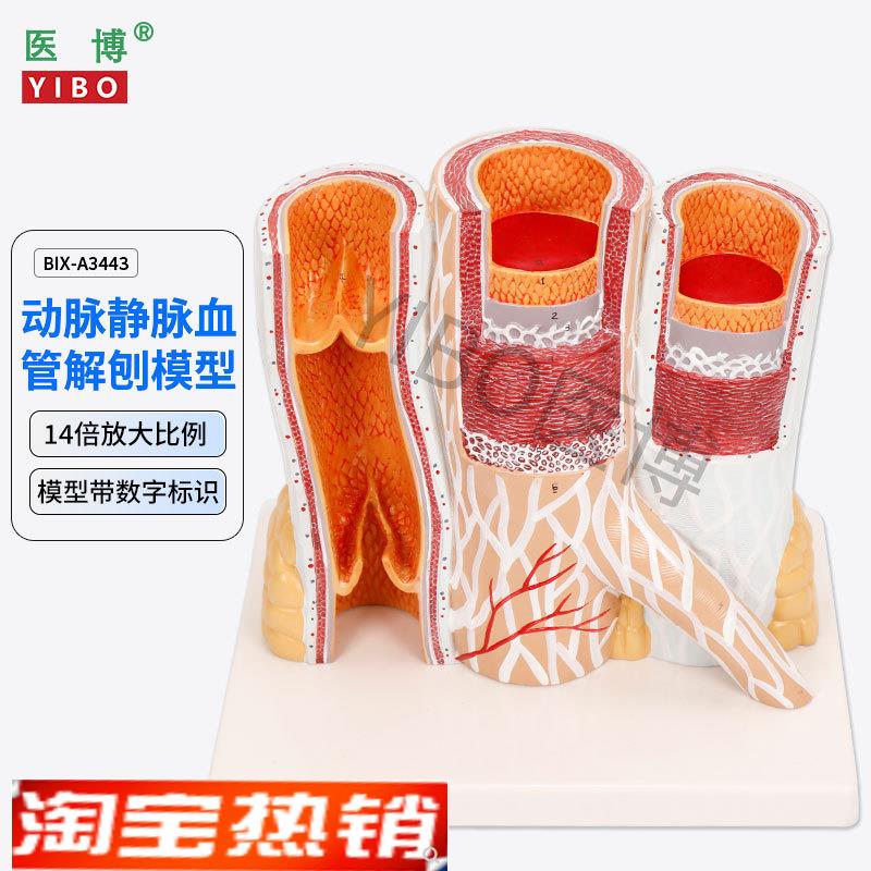 医博BIX-A3443动脉静脉血管解刨模型 人体血管解刨放大模型血管切