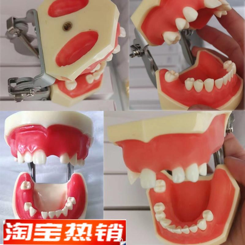 牙科种植模型上下缺失练习切开种植上颌窦提升术缝合仿骨质牙齿