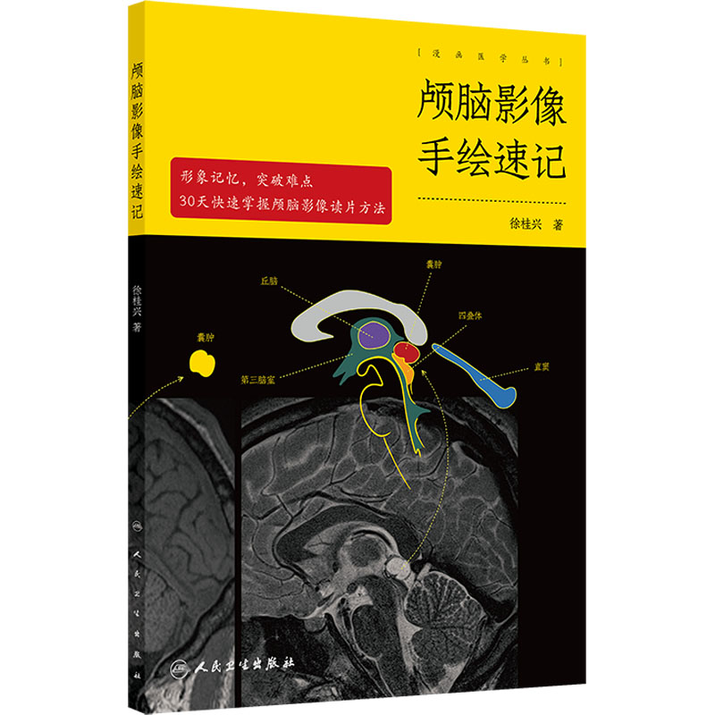 颅脑影像手绘速记 徐桂兴 著 影像医学 正常颅脑影像篇和颅脑病变影像篇  神经急诊重症医学影像等科室医生医学生 人民卫生出版社