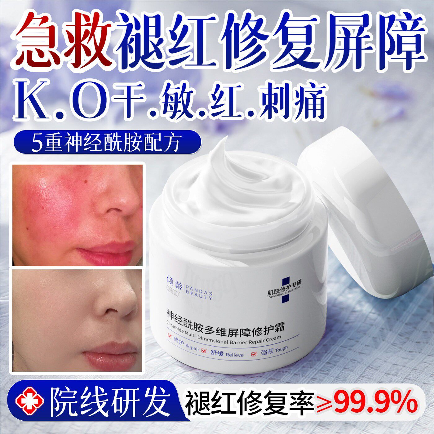面霜修复皮肤屏障肌肤受损修护舒缓泛红神经酰胺晒后修复皮肤晒伤