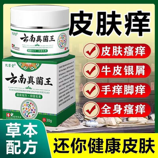 云南真菌王快速止痒皮肤瘙痒外用全身干痒止痒膏皮肤瘙痒特效抑菌
