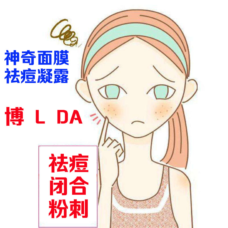 (美美)祛痘 面膜 涂抹式的   祛痘 调理 凝露 黑头 白头 粉刺等