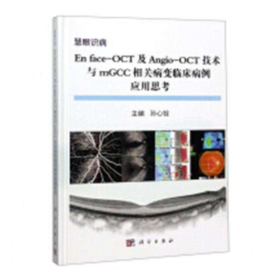 “RT正版” En face-OCT及Angio-OCT技术与mGCC相关病变临床病例应用思考科学出版社医药卫生图书书籍