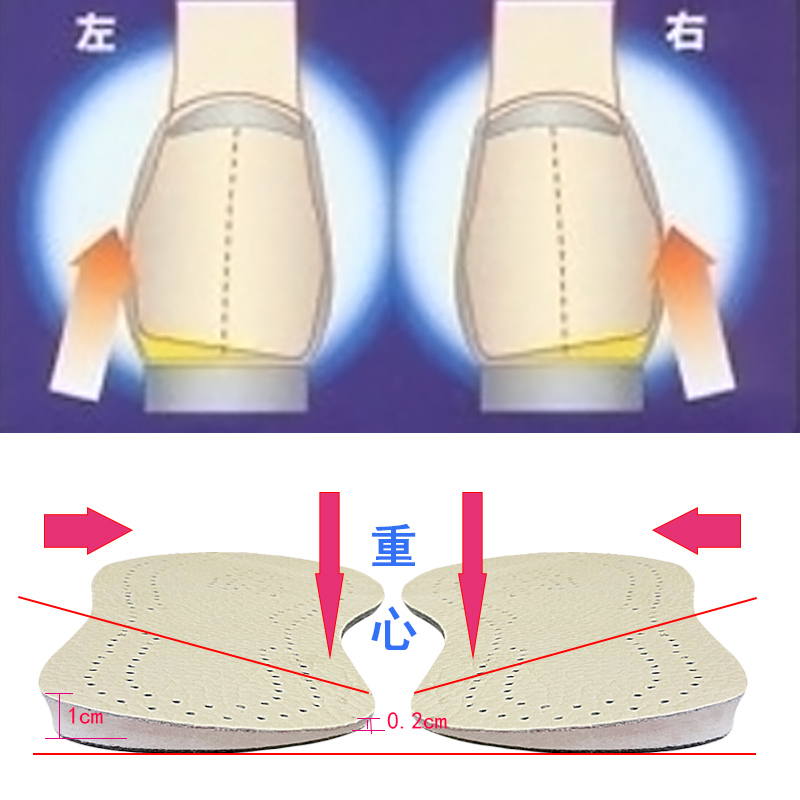 o型腿矫正鞋垫足内翻膝内翻腿型