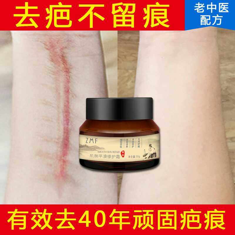 【祛疤神器】ZMF肌肤平滑修复膏 去手术伤疤凹凸疤烫烧伤疤妊娠纹