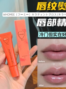 干唇大救星 日本whomee唇部精华美容液 护唇膏持续保湿润唇膏唇油