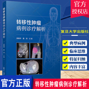 正版包邮 转移性肿瘤病例诊疗解析 梁晓华 詹琼 汇编了26个典型病例 病例突出循证医学的理念  复旦大学出版社