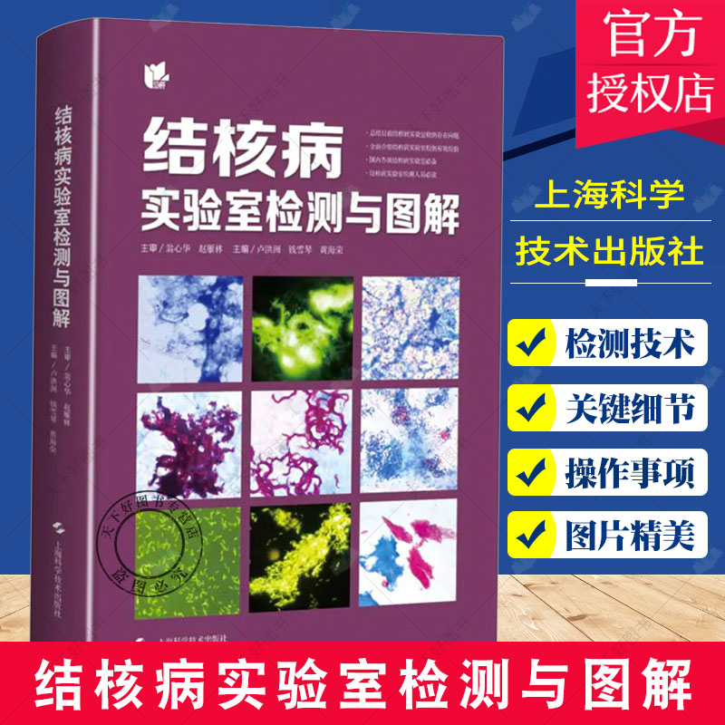 结核病实验室检测与图解 卢洪洲 等编 介绍目前结核病检测技术关键细节及操作注意事项 上海科学技术出版社书籍9787547853443