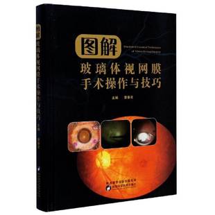 图解玻璃体视网膜手术操作与技巧 雷春灵普通大众玻璃体疾病视网膜疾病眼外科手术医药卫生书籍 精