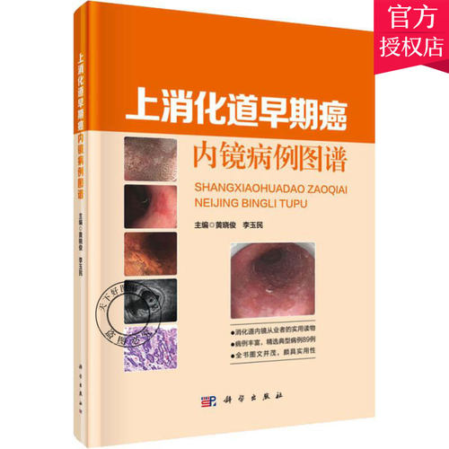 正版 上消化道早期癌内镜病例图谱 黄晓俊 消化系肿瘤书籍 消化内镜医师在上消化道早期癌规范化诊治参考书籍 早期食管癌案例书