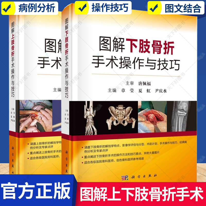 2册】图解上肢骨折手术操作与技巧+图解下肢骨折手术操作与技巧 股骨头骨折与脱位股骨颈股骨转子间股骨干股骨远端下肢骨折手术