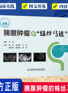 胰腺肿瘤的蛛丝马迹 王伟主编 科学技术文献出版社 胰腺肿瘤不等于胰腺癌?急性胰腺炎 传统影像学检查 超声内镜检查