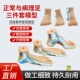教学人体足部肌肉解剖模型 高弓足部病理模型 正常足扁平足弓型足