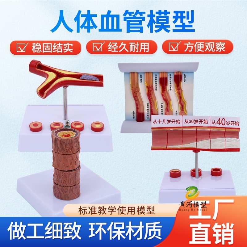 教学仿真人体病理血管堵塞动支脉粥样硬化心血管模型堵塞程度变化