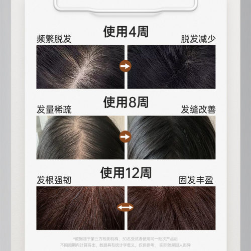 【认证有效防脱】之研防脱精华液