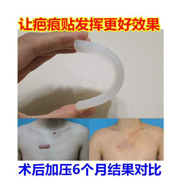 疤痕压力垫加压垫硅胶 配合疤痕运动护具