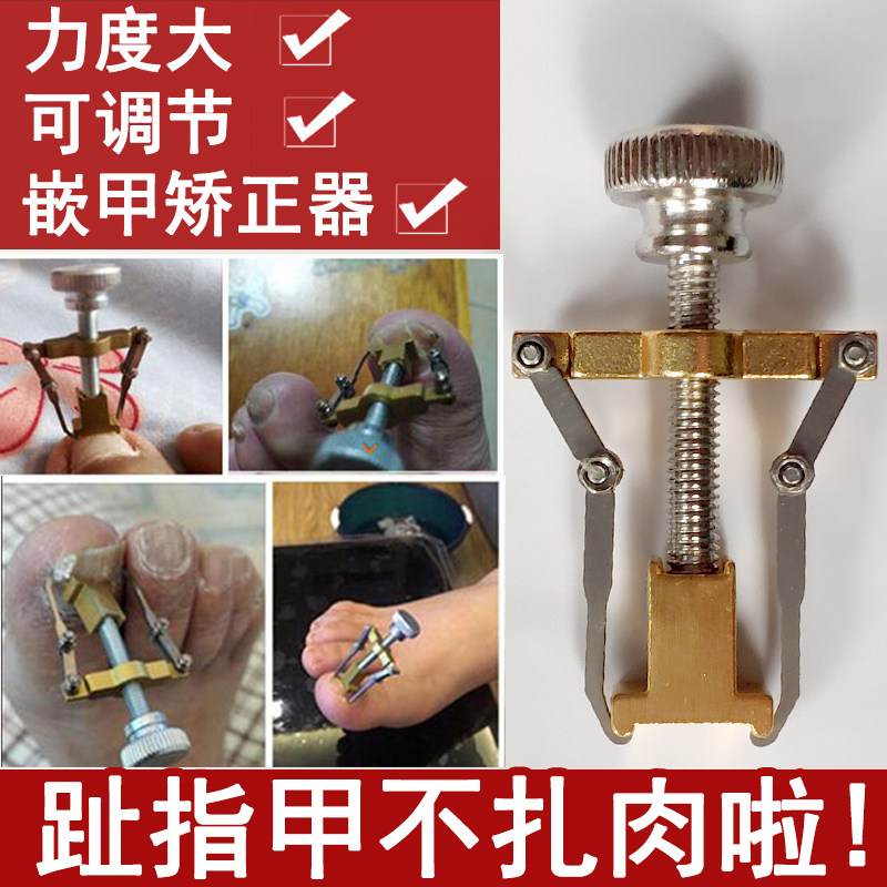 偏指甲矫正器甲沟神器炎内嵌外矫正脚趾甲嵌甲矫正器手指甲修正器