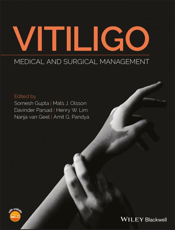 【按需印刷】WY Vitiligo怎么看?