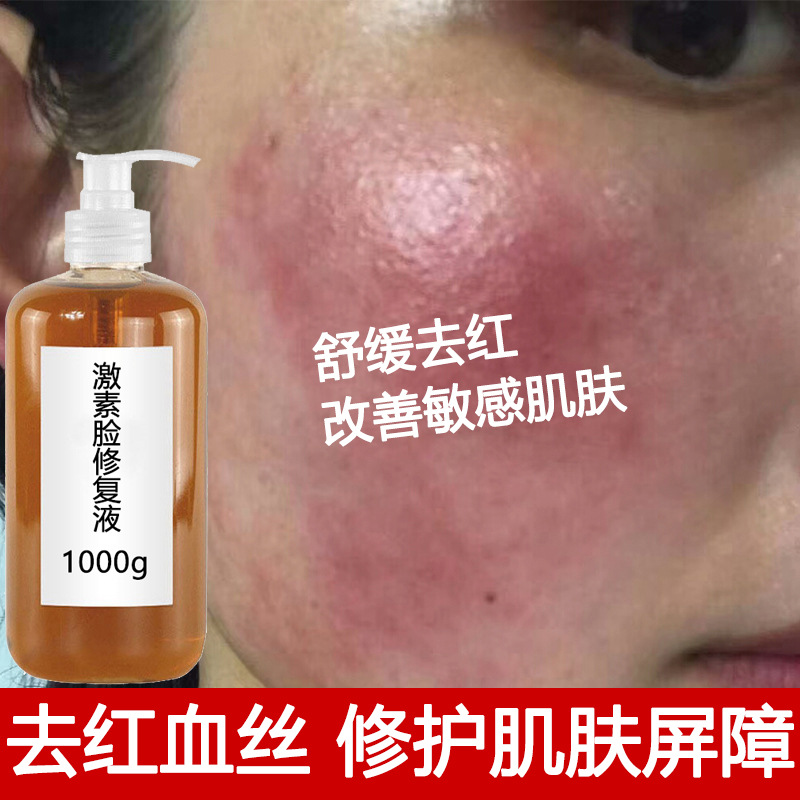 激素脸修复原液去红血丝舒缓敏感肌美容院装甘草积雪草修护精华液