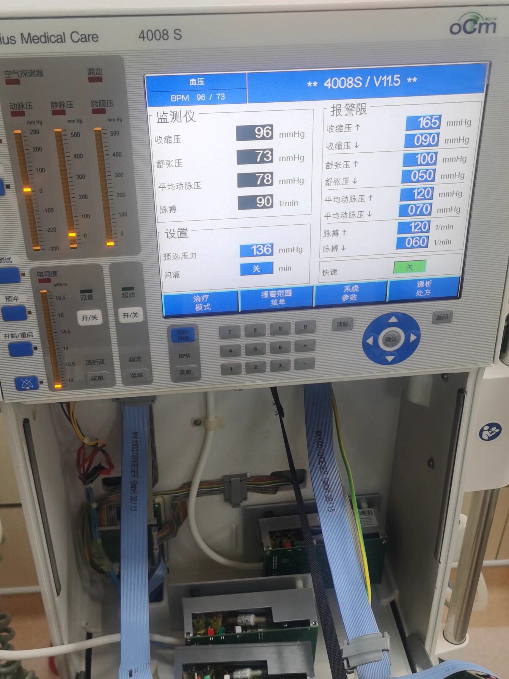 费森4008SV10BPM血压计模块