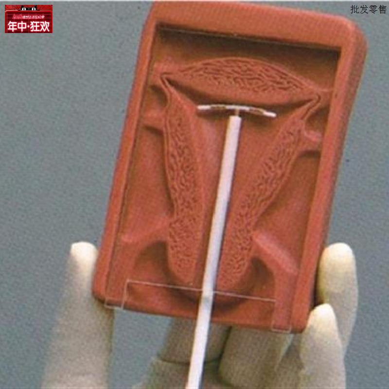 高级宫内避y孕器训练模型