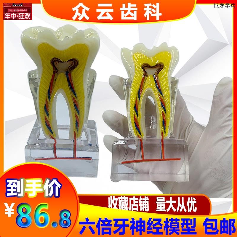 口腔牙科教学教具6倍牙神经模型水晶牙齿结Z构造解剖医患沟通包邮