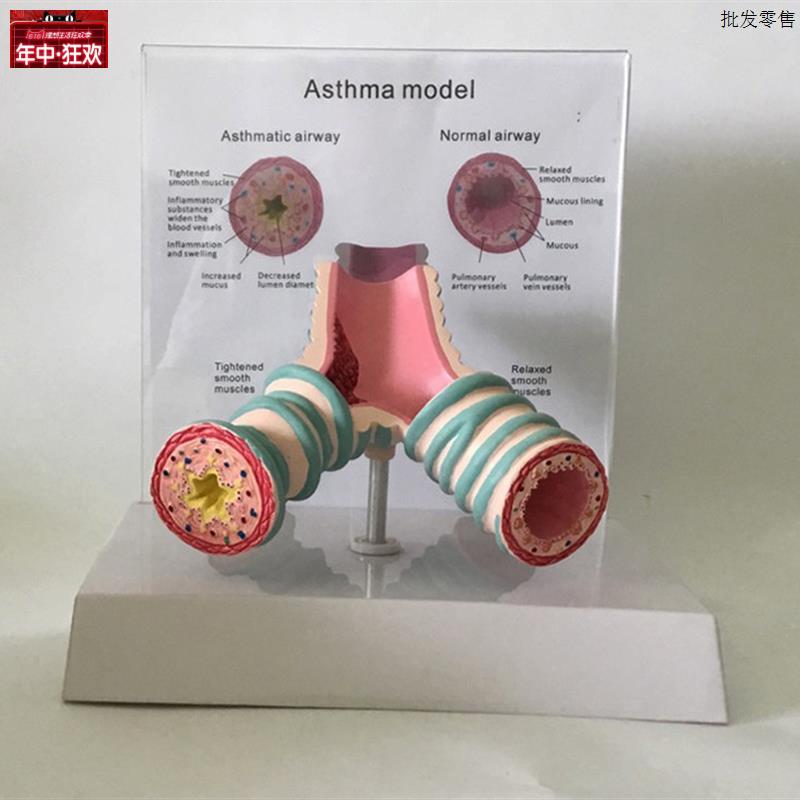 医疗用哮喘病气I管解剖模型支气管教学模型胸外科医学教学使用