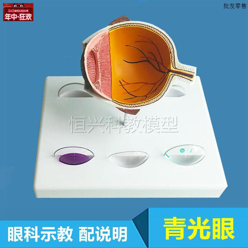 人青光眼模型眼睛视力眼科X示教眼底视网膜血管角膜晶状体模糊病