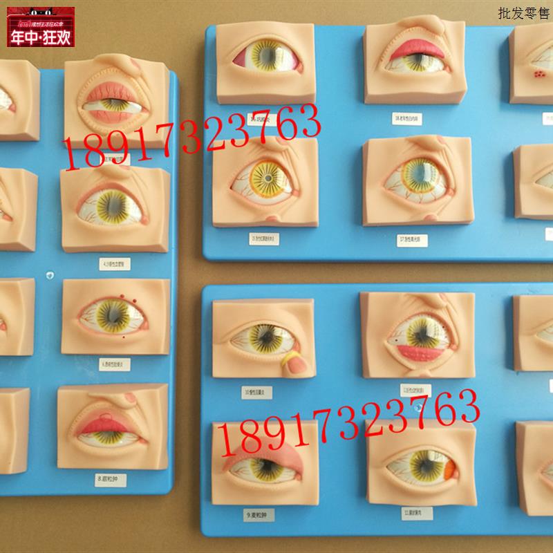 常见眼病模型20种s眼睛疾病模型眼科常见疾病模型眼球病变模型
