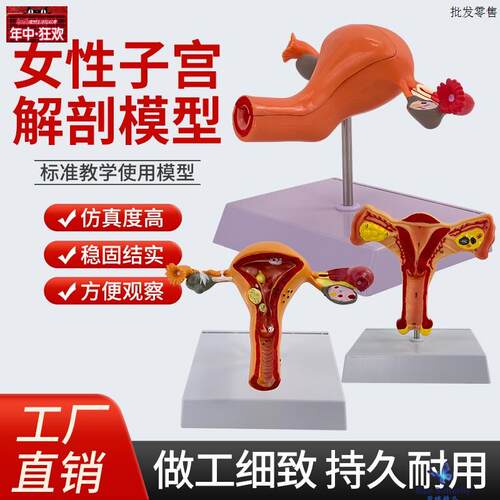 人体女性子宫卵巢阴道疾病模型生殖p科妇产科医患模型病理子宫模